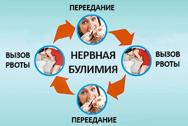 Лечение булимии в Нижнем Казанище